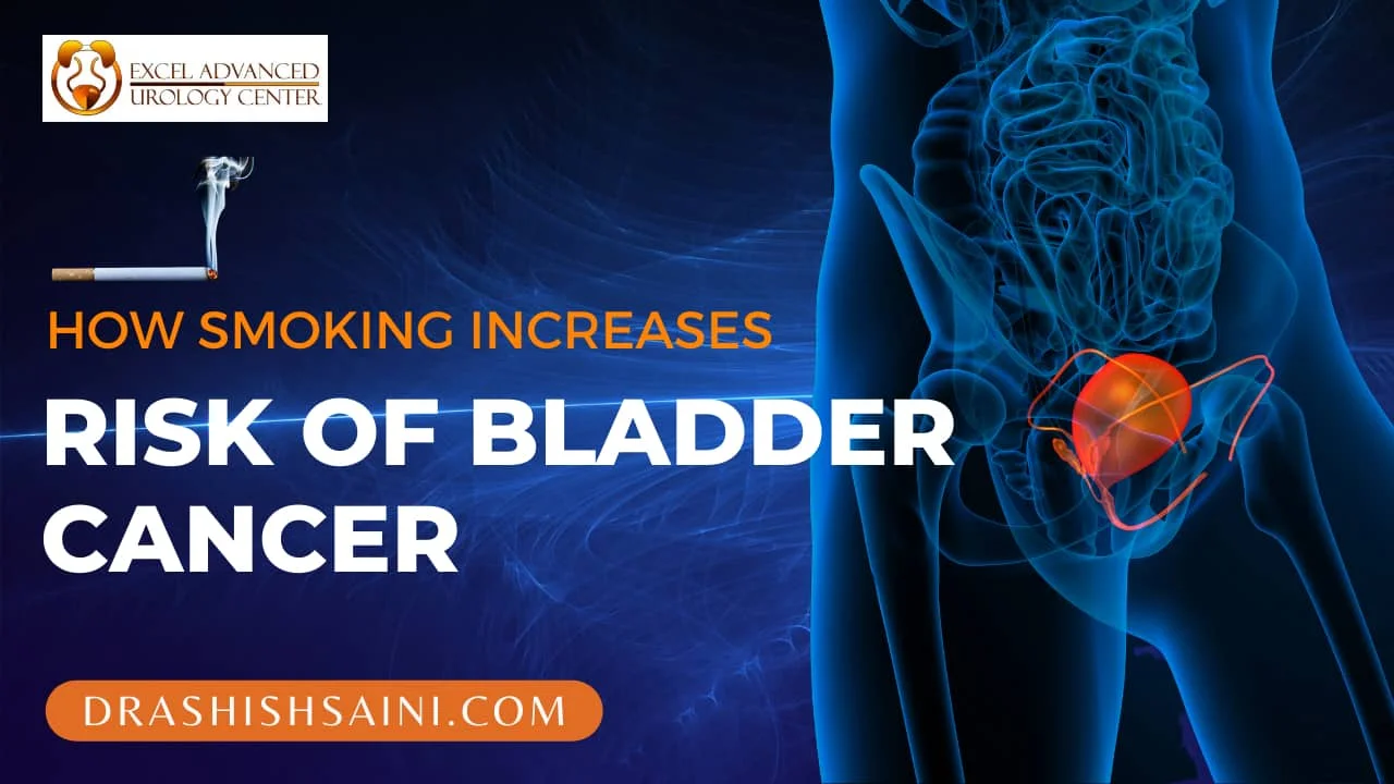 How Smoking Increases the Risk of Bladder Cancer – 2022 Tips