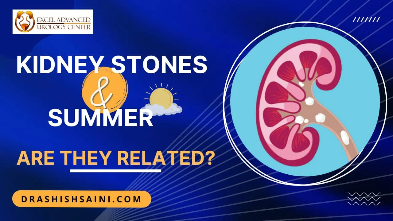 Kidney Stones and Summer – Are they related?