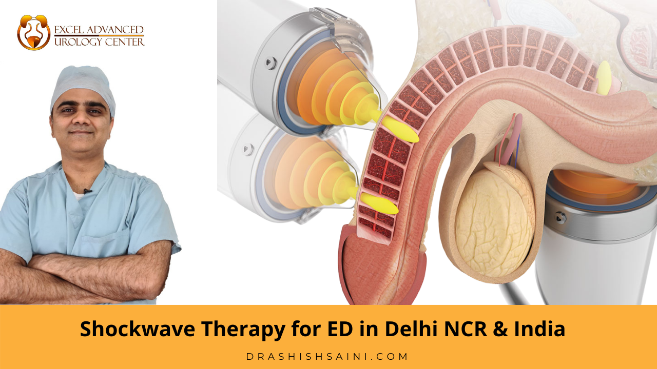 Shockwave therapy for ed