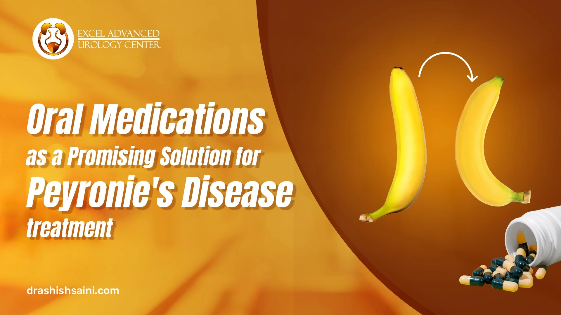 Oral Medications as a Promising Solution for Peyronie’s Disease Treatment