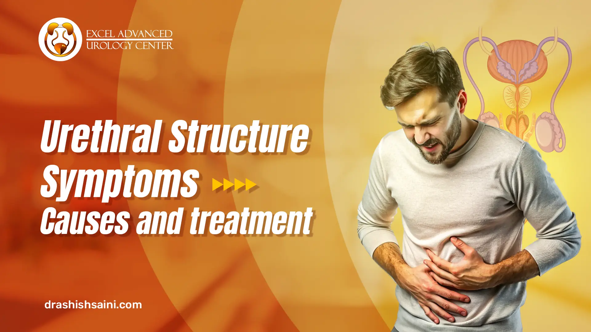 Urethral Stricture Symptoms: Causes and Treatment