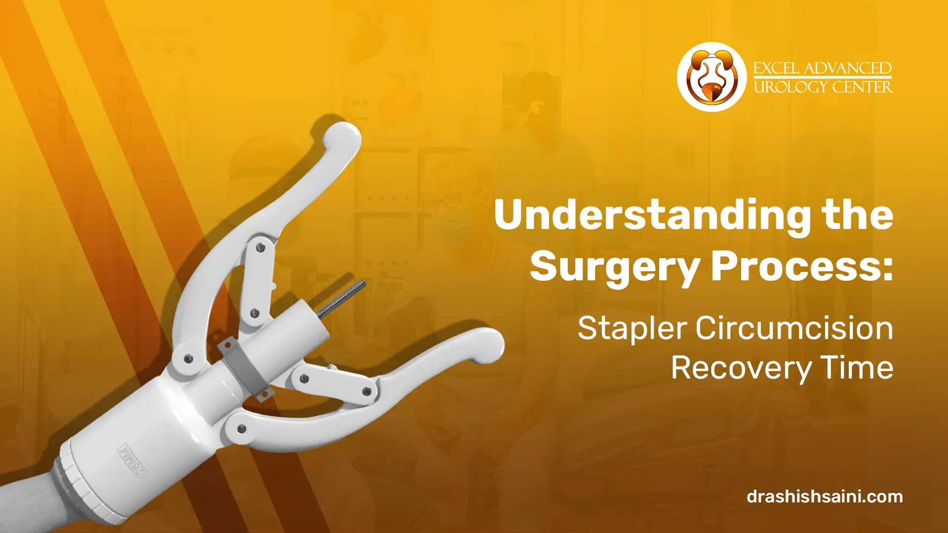 Understanding the surgery Process: Stapler Circumcision Recovery Time