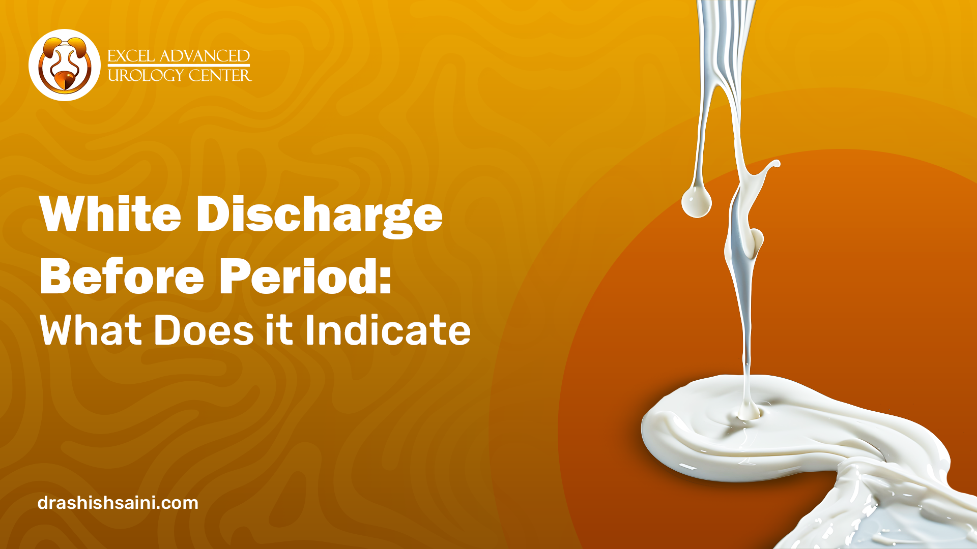 White Discharge Before Period: What Does it Indicate?